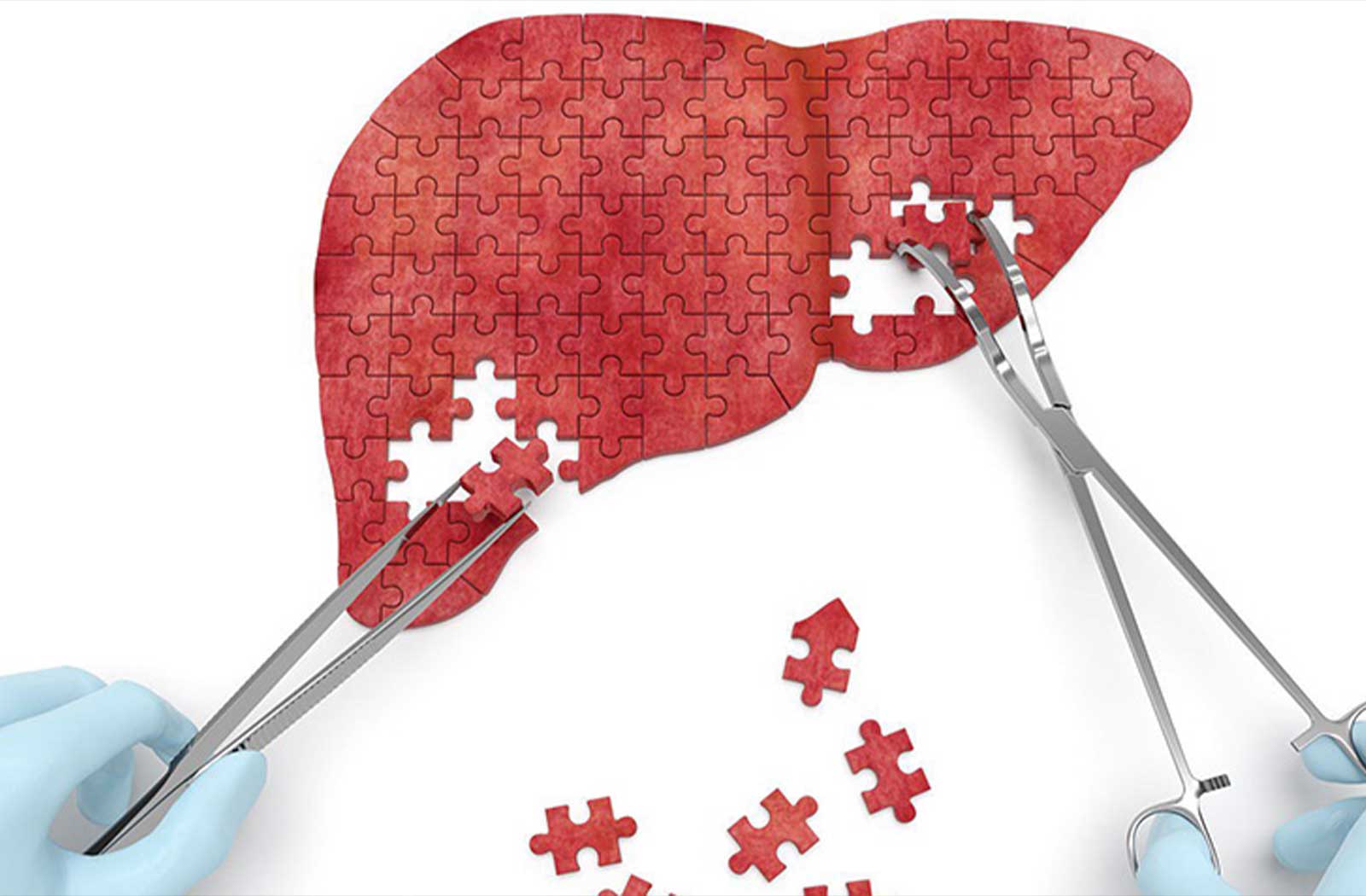Karaciğer Sağlığını Koruyan 6 Bileşen